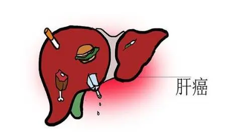 仑伐替尼(Lenvima)需要多长时间才能起疗效? 仑伐替尼(Lenvima)需要多长时间才能起疗效?