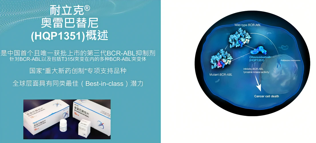 奥维伦巴替尼在耐TKI的CML和Ph+ ALL中显示出前景 奥维伦巴替尼在耐TKI的CML和Ph+ ALL中显示出前景