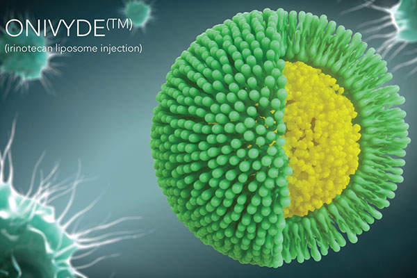 伊立替康脂质体（Onivyde）治疗转移性胰腺癌效果如何？